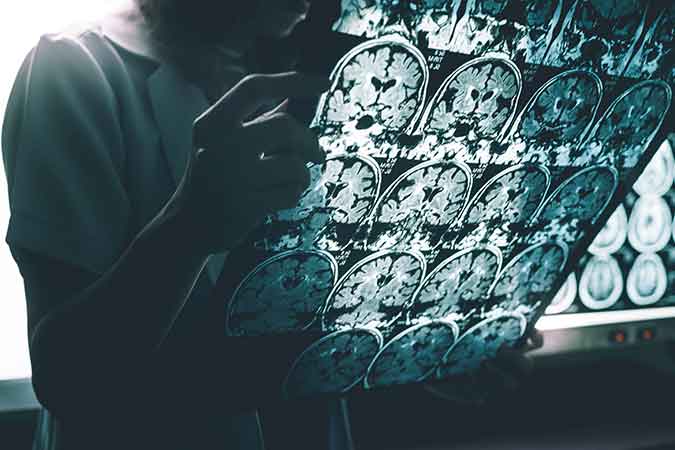 A researcher reviews a series of MRI slices of a brain.