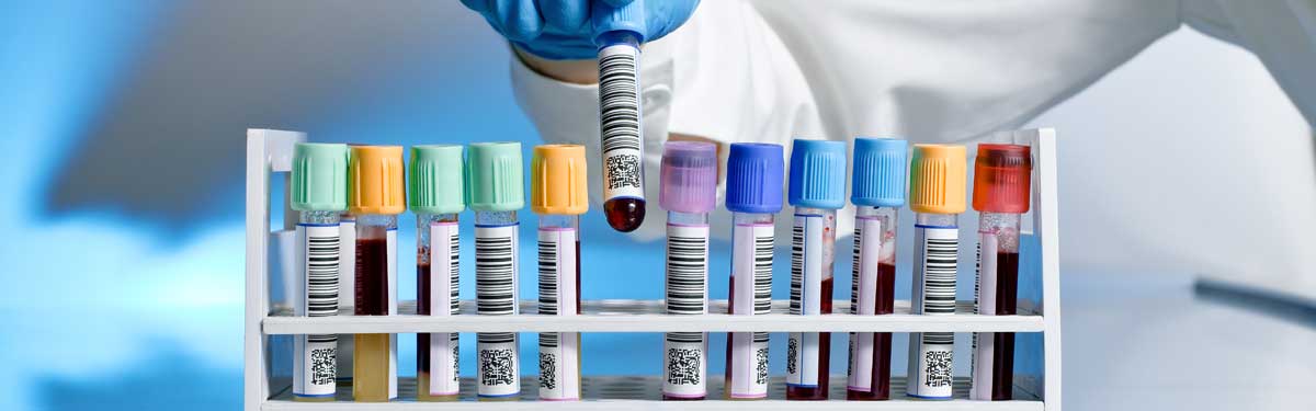 Blood samples are processed in a lab.